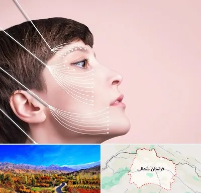 اندولیفت پیشانی در خراسان شمالی