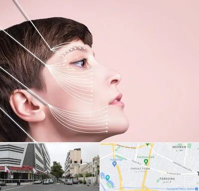 اندولیفت پیشانی در بلوار فردوس 