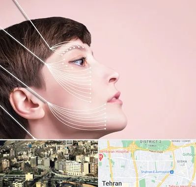 اندولیفت پیشانی در مرزداران 