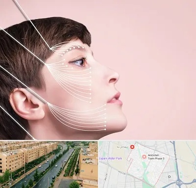 اندولیفت پیشانی در فاز سه اندیشه