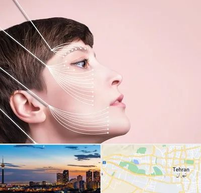 اندولیفت پیشانی در غرب تهران 