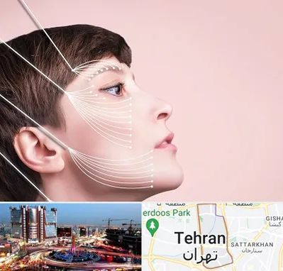 اندولیفت پیشانی در صادقیه 