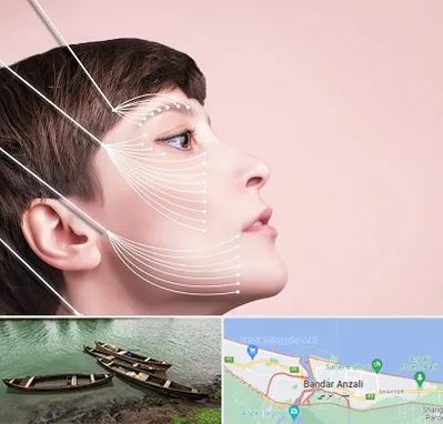 اندولیفت پیشانی در بندر انزلی