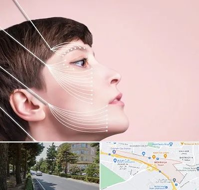 اندولیفت پیشانی در مهرویلا کرج