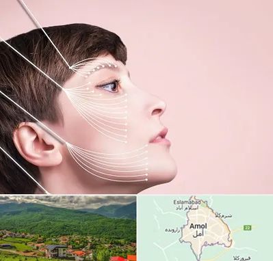 اندولیفت پیشانی در آمل