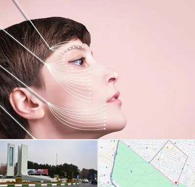 اندولیفت پیشانی در بلوار فلسیطین مشهد