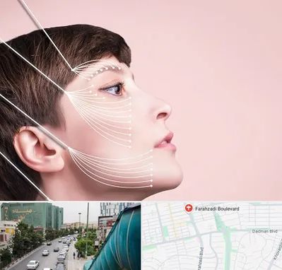 اندولیفت پیشانی در بلوار فرحزادی