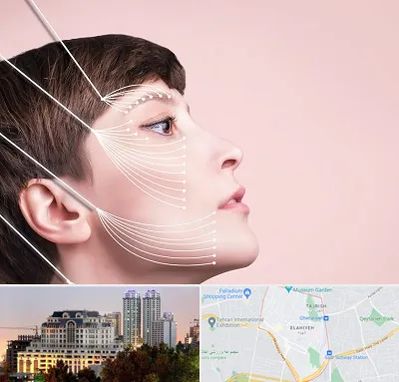 اندولیفت پیشانی در فرشته 