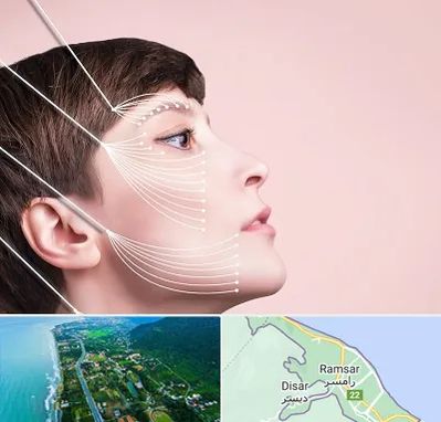 اندولیفت پیشانی در رامسر