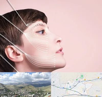 اندولیفت پیشانی در رودهن