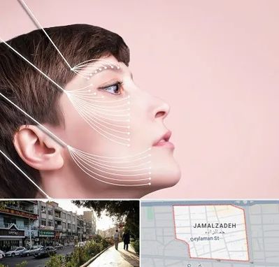 اندولیفت پیشانی در خیابان جمالزاده