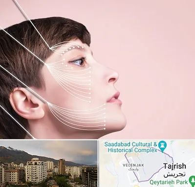 اندولیفت پیشانی در زعفرانیه 