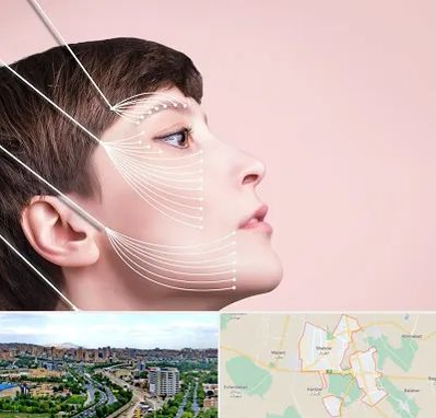 اندولیفت پیشانی در شهریار