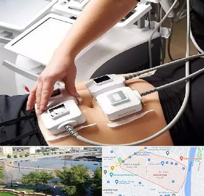 ترواسکالپ در گلستان اهواز