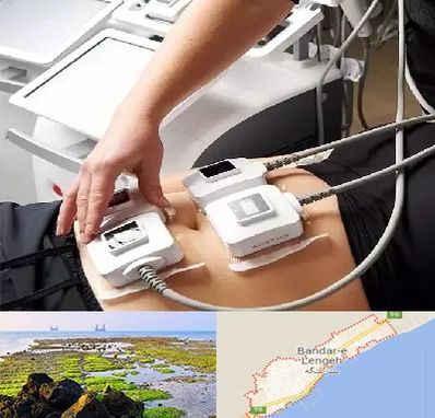 ترواسکالپ در بندرلنگه