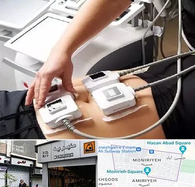 ترواسکالپ در منیریه 