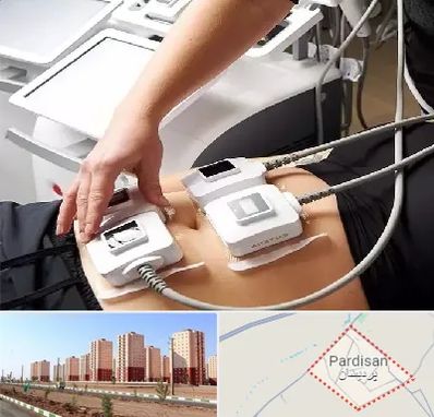 ترواسکالپ در پردیسان قم