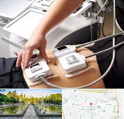 ترواسکالپ در سرسبز 