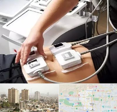 ترواسکالپ در منطقه 5 تهران 