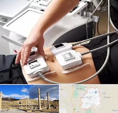 ترواسکالپ در مرودشت