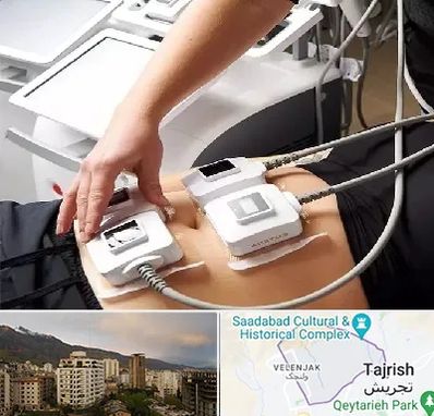 ترواسکالپ در زعفرانیه 