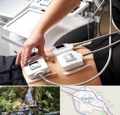ترواسکالپ در الیگودرز