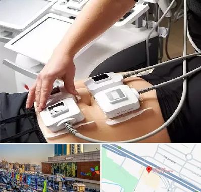 ترواسکالپ در لاله پارک تبریز