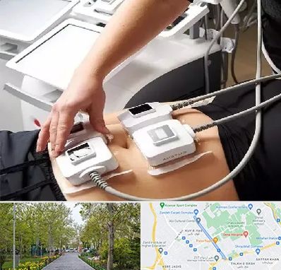 ترواسکالپ در قدوسی غربی شیراز