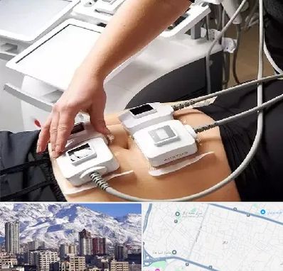 ترواسکالپ در ازگل