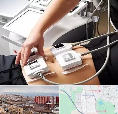 ترواسکالپ در سهند تبریز