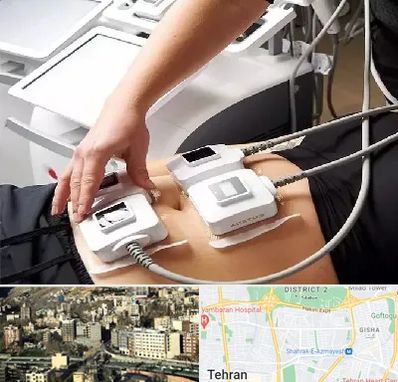 ترواسکالپ در مرزداران 