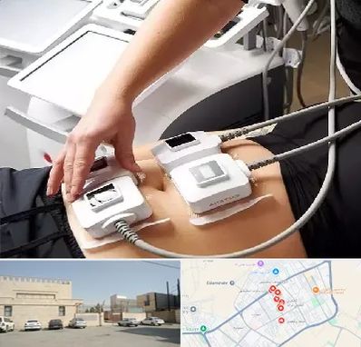 ترواسکالپ در نواب اسلامشهر