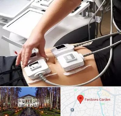 ترواسکالپ در باغ فردوس