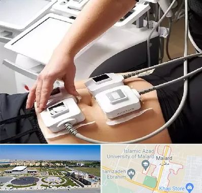 ترواسکالپ در ملارد