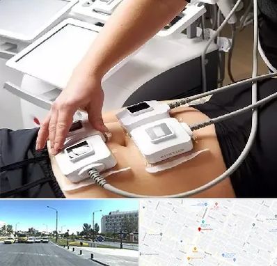 ترواسکالپ در بلوار کلاهدوز مشهد 