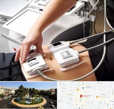 ترواسکالپ در هفت حوض 