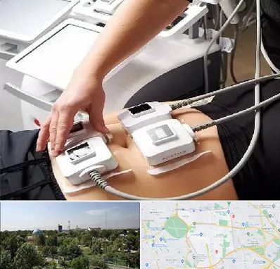 ترواسکالپ در منطقه 16 تهران 