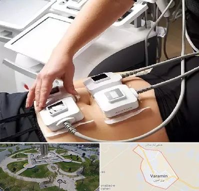 ترواسکالپ در ورامین