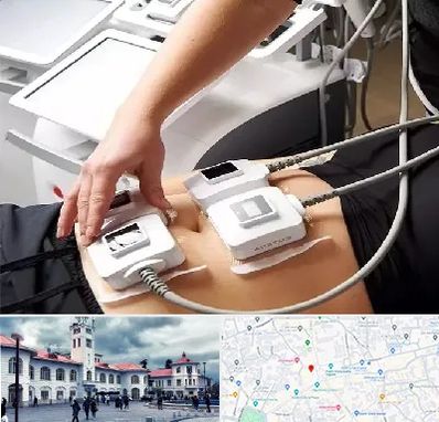 ترواسکالپ در میدان شهرداری رشت