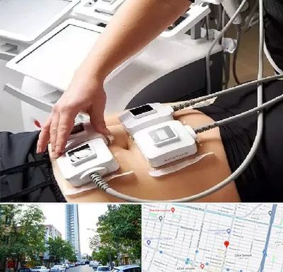 ترواسکالپ در امامت مشهد