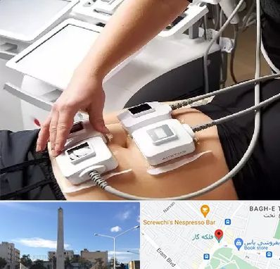 ترواسکالپ در فلکه گاز شیراز