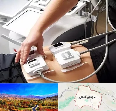 ترواسکالپ در خراسان شمالی