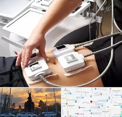 ترواسکالپ در میدان حر 