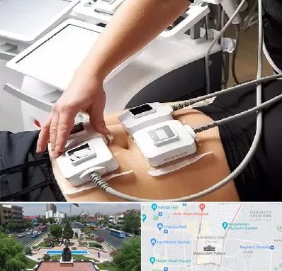 ترواسکالپ در بهارستان 