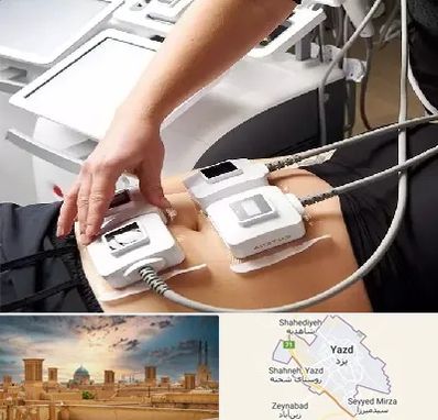 ترواسکالپ در یزد