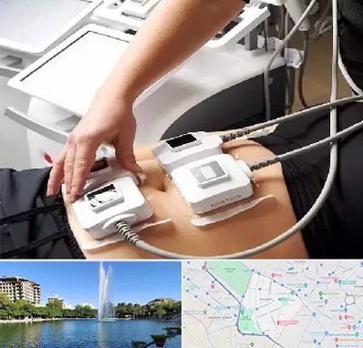 ترواسکالپ در کوهسنگی مشهد