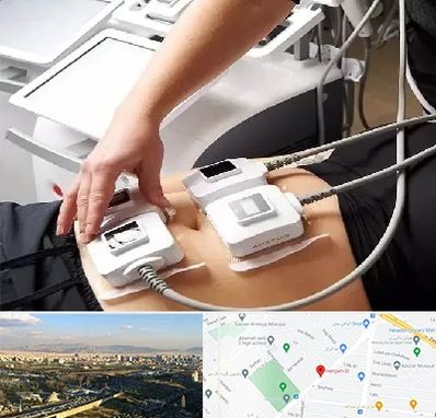 ترواسکالپ در هنگام 