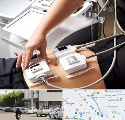 ترواسکالپ در قدوسی شرقی شیراز