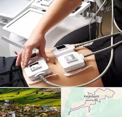 ترواسکالپ در کلاردشت