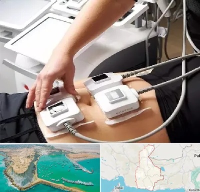ترواسکالپ در سیستان و بلوچستان